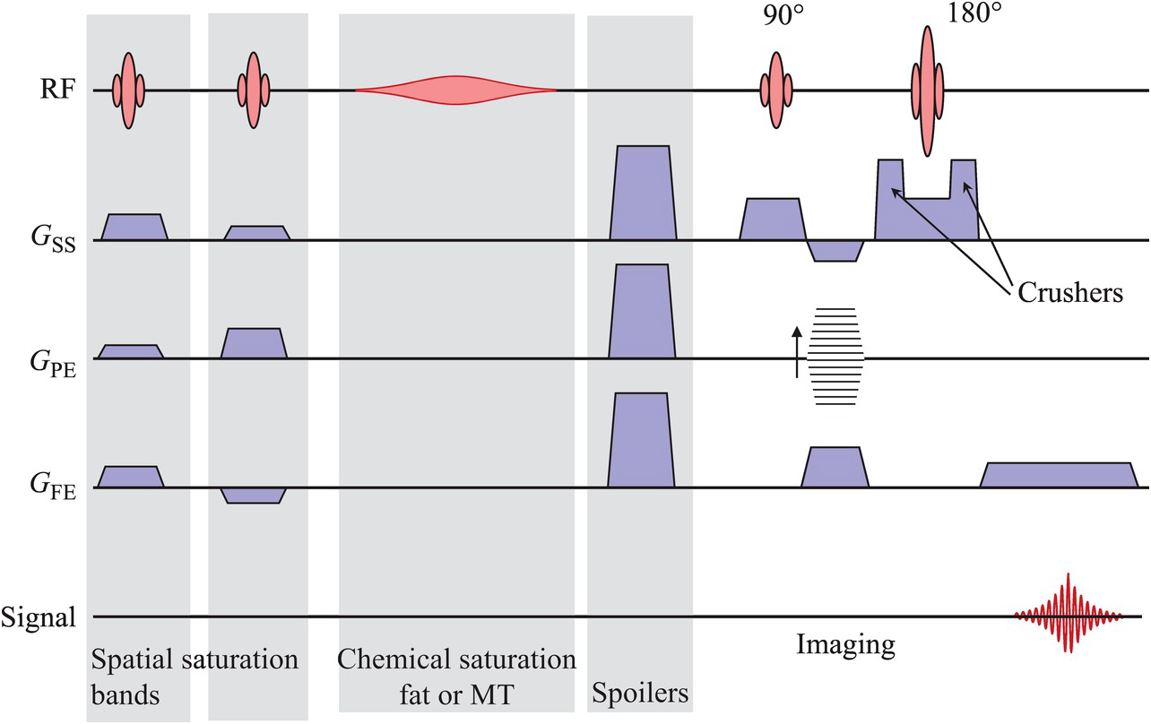 A spin-echo pulse sequence depicted as a block diagram. The first half is greyed out and labelled with various pre-sequence pulses like fat supression and spoilers, then there's the spin-echo sequence showing the excitation and refocusing pulses, gradients and FID produced.